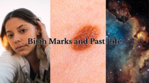 Birth Marks and Past Life